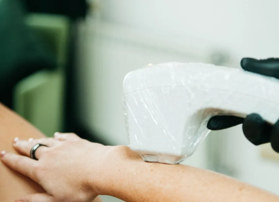 Professional Laser Hair Removal Treatment